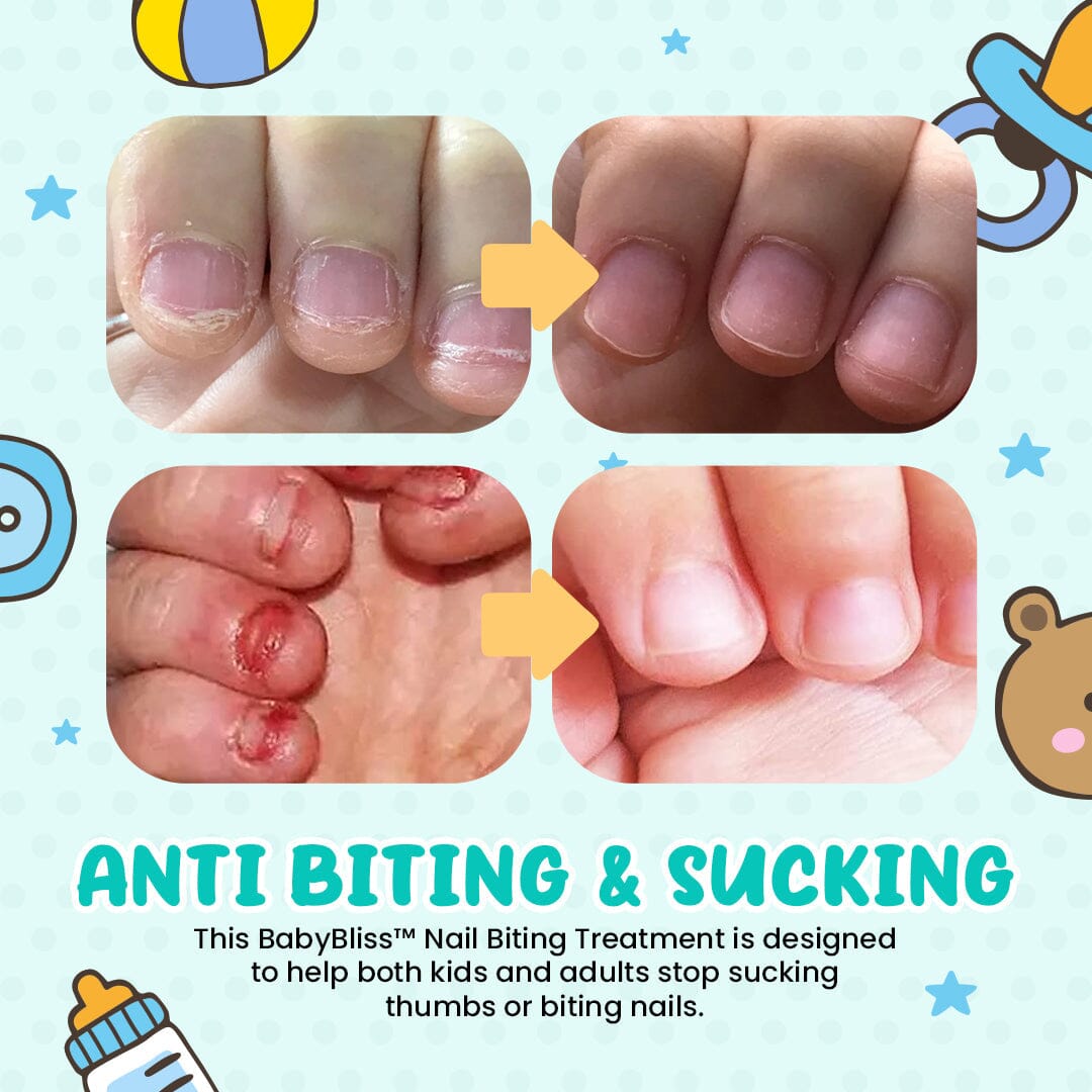 BabyBliss™ Nail Biting Treatment