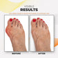 Feetin™ Bunion Relief Fit Patch